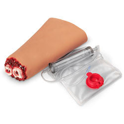 Wound - Hand Amputation